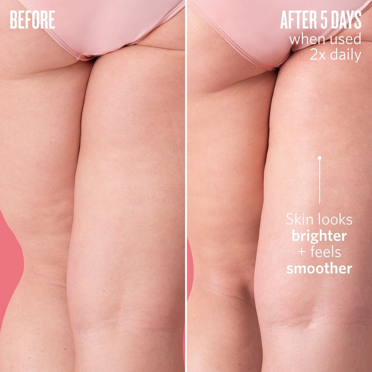 Before // After 5 days when used 2x daily, skin looks brighter + feels smoother.