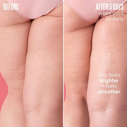 Before // After 5 days when used 2x daily, skin looks brighter + feels smoother.