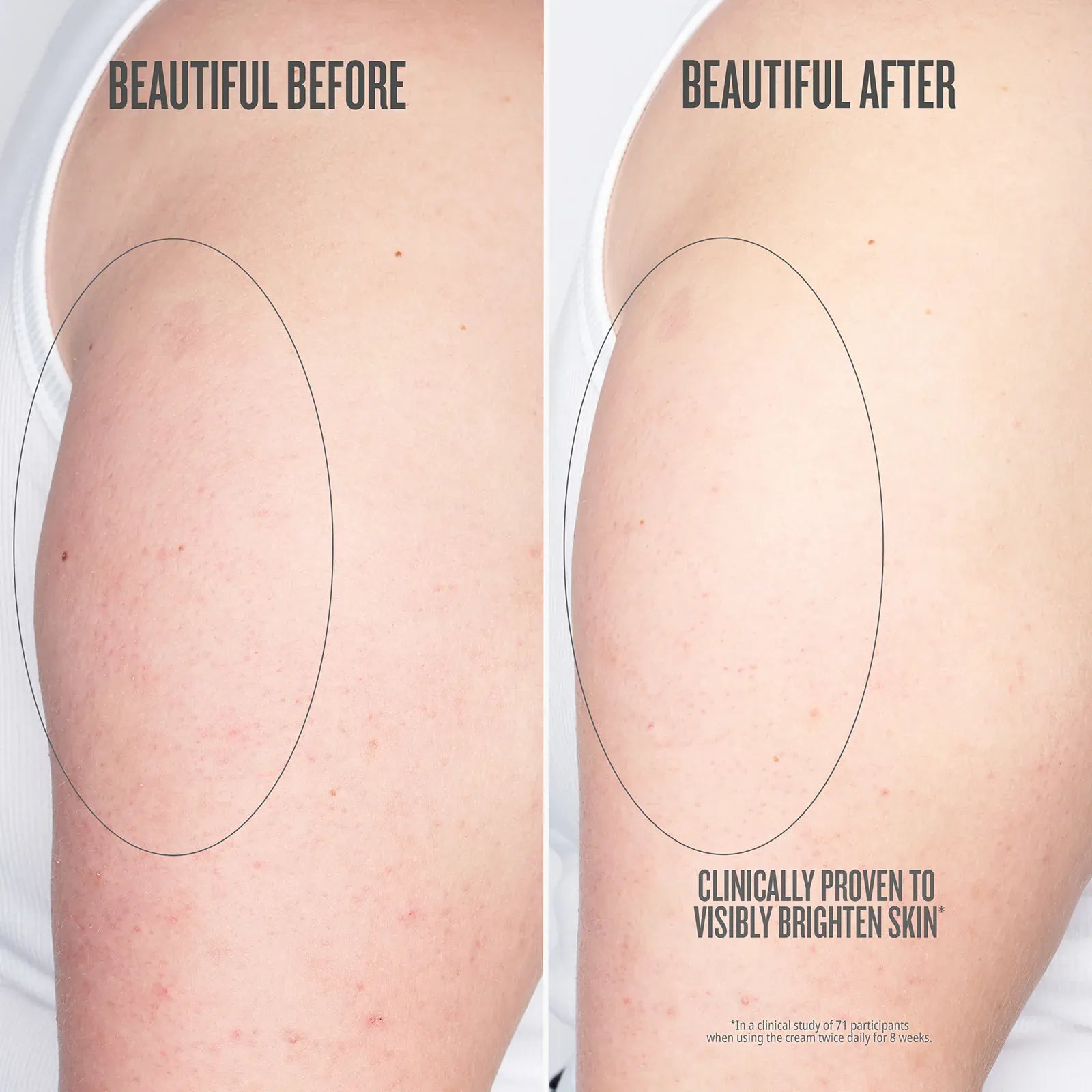 Before // After clinically proven to visibly brighten skin*