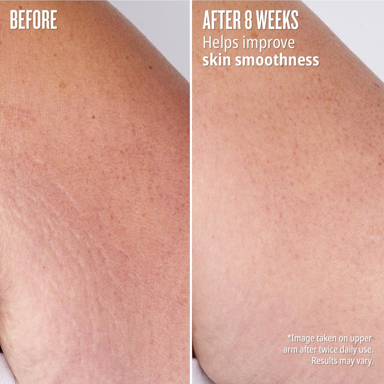 Before // After 8 weeks - helps improve skin smoothness. *image taken on upper arm after twice daily use. Results may vary.