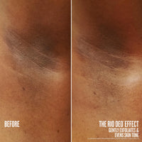 before // after the rio deo effect