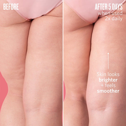 before - after 5 days - when used 2x daily - skin looks brighter + feels smoother
